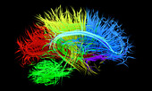 Human brain nerve tracts, illustration