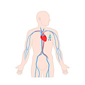 Central venous catheter, illustration