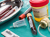 Urine and blood samples at hospital table, conceptual image