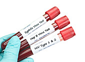 STD blood tests