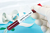 Syphilis blood test