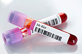 Haemoglobin A1c blood test