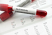 Hepatitis B antibody blood test