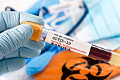 Coronavirus covid-19 blood test in gloved hand