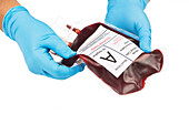 Type A donated blood unit