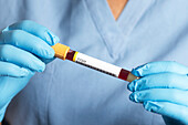 Gold cap blood test tube