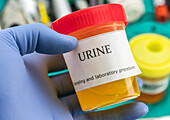 Lab technician working with urine sample