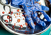 Blue gloves and scissors stained with blood on a tray