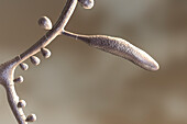 Trichophyton rubrum fungi, artwork
