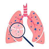 Lung disease, conceptual illustration