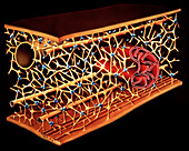 Microtrabecular network, illustration