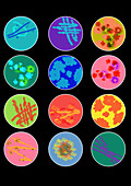 Samples in petri dishes, illustration