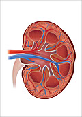 Cat kidney with hypertension, illustration