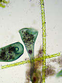 Stentor coeruleus, light micrograph