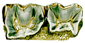 Teeth, light micrograph