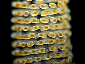 Midge eggs, light micrograph