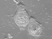 Protozoa, light micrograph