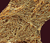 Collagen fibres, SEM