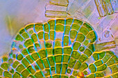 Phycopeltis green alga and diatoms, light micrograph
