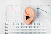 Diagnosis of hearing impairment, conceptual image