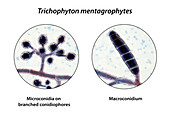 Fungi Trichophyton mentagrophytes, illustration