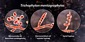 Fungi Trichophyton mentagrophytes, illustration