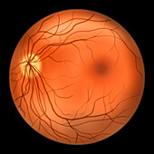 Healthy retina,