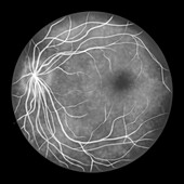 Fluorescein angiogram of a healthy retina, illustration