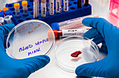 Mink blood sample for covid-19 testing, conceptual image