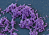 Chromobacterium vaccinii bacteria, SEM