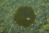 Amoeba fruiting body, light micrograph
