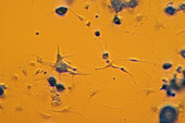 Trigeminal ganglion neurons, light micrograph