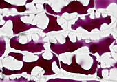 Red onion cells, light micrograph