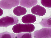 Red onion cells, light micrograph