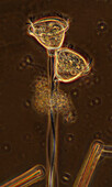 Vorticella sp. ciliate, light micrograph