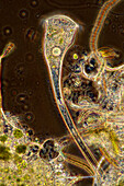 Stentor sp. ciliates, light micrograph