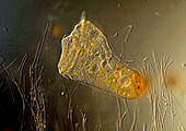 Stentor sp. ciliate, light micrograph