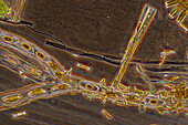 Cymbella sp. diatoms, light micrograph