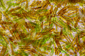 Epithemia diatoms, light micrograph