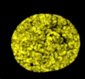 Nucleus in late prophase, light micrograph
