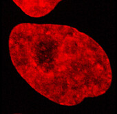 Cell nucleus in interphase, light micrograph