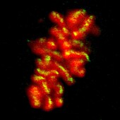 Human chromosomes in metaphase, light micrograph