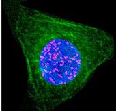 Human cell in interphase, light micrograph