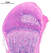 Developing long bone, light micrograph