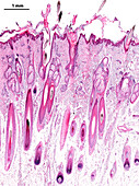 Human scalp, light micrograph