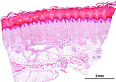 Sole of the foot, light micrograph