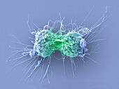 Cervical cancer cells dividing, SEM