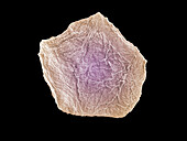 Human skin cell, SEM