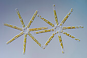 Tabellaria fenestrata , light micrograph