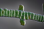 Stigonema mammilosum cyanobacteria, light micrograph